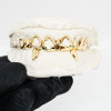 Achetez le bijoux Grillz 10 dent + Interstice + Open Face Diamond Emerald - Or 18K chez Dreamgold Paris