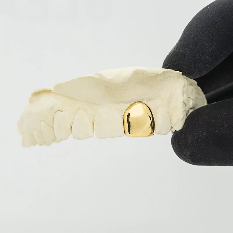 Achetez le bijoux Grillz 1 dent - Or 18K chez Dreamgold Paris
