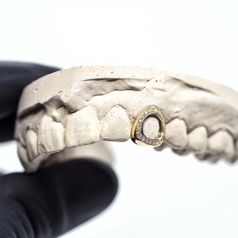 Achetez le bijoux Grillz 1 dent open face + diamonds - Or 18K chez Dreamgold Paris