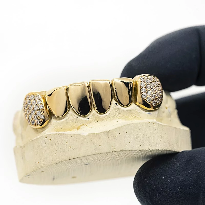 Achetez le bijoux Grillz 6 dents + Diamants - Or 18K chez Dreamgold Paris
